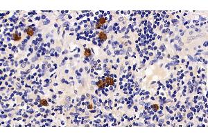 Detection of PD1 in Human Kidney Tissue using Polyclonal Antibody to Programmed Cell Death Protein 1 (PD1) (PD-1 anticorps  (AA 41-132))