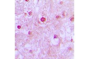 Immunohistochemical analysis of CDK10 staining in human brain formalin fixed paraffin embedded tissue section.
