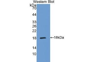 Western Blotting (WB) image for anti-Interleukin 5 Receptor, alpha (IL5RA) (AA 42-182) antibody (ABIN3206510) (IL5RA anticorps  (AA 42-182))