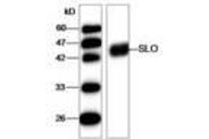 Image no. 1 for anti-Streptolysin O (SLO) (AA 78-206) antibody (ABIN791625) (Streptolysin O anticorps  (AA 78-206))