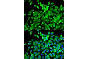 Immunofluorescence (IF) image for anti-Eukaryotic Translation Initiation Factor 4A2 (EIF4A2) antibody (ABIN1876482) (EIF4A2 anticorps)