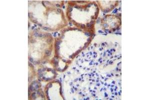 Formalin fixed and paraffin embedded human kidney tissue stained with STARD4 Antibody (N-term) Cat. (STARD4 anticorps  (N-Term))