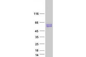 Validation with Western Blot (BCL3 Protein (Myc-DYKDDDDK Tag))