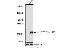 Western blot analysis of extracts of HeLa cells, using Phospho-HSP27/HSPB1-S78 Rabbit mAb (ABIN7267570) at 1:1000 dilution. (HSP27 anticorps  (pSer78))