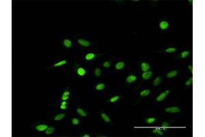 Immunofluorescence of purified MaxPab antibody to RPA1 on HeLa cell. (RPA1 anticorps  (AA 1-616))