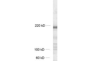 Western Blotting (WB) image for anti-G Protein-Coupled Receptor Associated Sorting Protein 1 (GPRASP1) (AA 64-440) antibody (ABIN1742524) (GPRASP1 anticorps  (AA 64-440))
