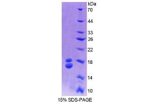 SDS-PAGE analysis of Cow RBP1 Protein. (RBP1 Protéine)