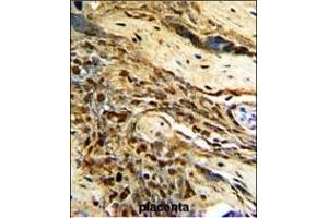 Formalin-fixed and paraffin-embedded human placenta with MGMT Antibody (C-term), which was peroxidase-conjugated to the secondary antibody, followed by DAB staining.