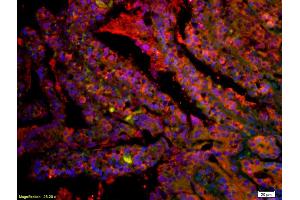 anti-CD8a Molecule (CD8A) (AA 51-150) antibody