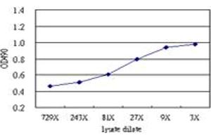 ZSCAN20 (Human) Matched Antibody Pair
