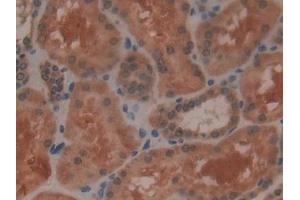 Detection of GPX4 in Human Kidney Tissue using Polyclonal Antibody to Glutathione Peroxidase 4 (GPX4)