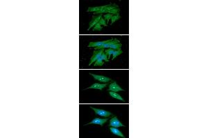 ICC/IF analysis of PDCL3 in HeLa cells line, stained with DAPI (Blue) for nucleus staining and monoclonal anti-human PDCL3 antibody (1:100) with goat anti-mouse IgG-Alexa fluor 488 conjugate (Green). (PDCL3 anticorps)