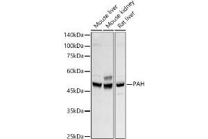 Western blot analysis of extracts of various cell lines, using PAH antibody (ABIN7269264) at 1:500 dilution. (Phenylalanine Hydroxylase anticorps)