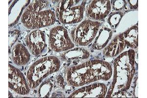 Image no. 2 for anti-DEAD (Asp-Glu-Ala-Asp) Box Polypeptide 58 (DDX58) antibody (ABIN1500708) (DDX58 anticorps)