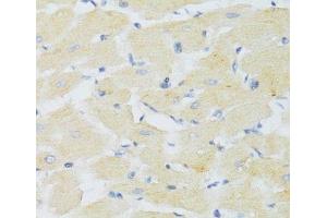 Immunohistochemistry of paraffin-embedded Mouse heart using CXCR3 Polyclonal Antibody at dilution of 1:100 (40x lens). (CXCR3 anticorps)