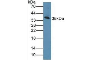 Figure. (CD1d anticorps  (AA 56-271))