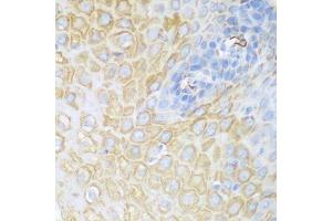 Immunohistochemistry of paraffin-embedded human esophagus using CDK1 antibody.