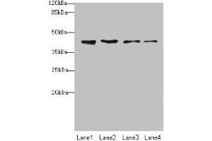 Western blot All lanes: NUP43 antibody at 4 μg/mL Lane 1: A431 whole cell lysate Lane 2: HL60 whole cell lysate Lane 3: THP-1 whole cell lysate Lane 4: A549 whole cell lysate Secondary Goat polyclonal to rabbit IgG at 1/10000 dilution Predicted band size: 43, 32 kDa Observed band size: 43 kDa (NUP43 anticorps  (AA 1-200))