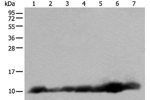 Western blot analysis of 293T and RAW264. (C14orf2 anticorps)