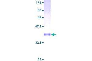 Image no. 1 for Cornichon Homolog 3 (CNIH3) (AA 1-160) protein (GST tag) (ABIN1349824)