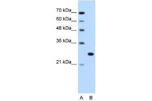 Western Blot showing FOXR2 antibody used at a concentration of 1-2 ug/ml to detect its target protein. (FOXR2 anticorps  (N-Term))