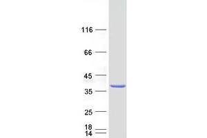 Validation with Western Blot