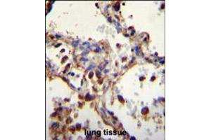 WDR52 Antibody immunohistochemistry analysis in formalin fixed and paraffin embedded human lung tissue followed by peroxidase conjugation of the secondary antibody and DAB staining. (WDR52 anticorps  (C-Term))