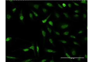 Immunofluorescence of monoclonal antibody to SNAPC4 on HeLa cell. (SNAPC4 anticorps  (AA 53-162))
