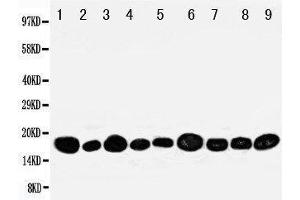 Western Blotting (WB) image for anti-Nucleoside diphosphate kinase B (NME2) (AA 137-152), (C-Term) antibody (ABIN3044198) (NME2 anticorps  (C-Term))