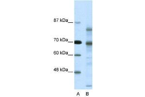 WB Suggested Anti-NCOR2  Antibody Titration: 0. (NCOR2 anticorps  (N-Term))