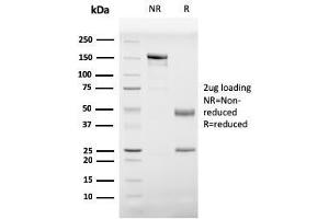 SDS-PAGE Analysis Purified Prohibitin Mouse Monoclonal Antibody (PHB/3229). (Prohibitin anticorps  (AA 167-261))