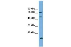 Image no. 1 for anti-DnaJ (Hsp40) Homolog, Subfamily A, Member 2 (DNAJA2) (AA 35-84) antibody (ABIN6744936) (DNAJA2 anticorps  (AA 35-84))