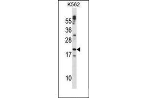 Western blot analysis of Cardiotrophin-1 Antibody (C-term) in K562 cell line lysates (35ug/lane). (Cardiotrophin 1 anticorps  (C-Term))