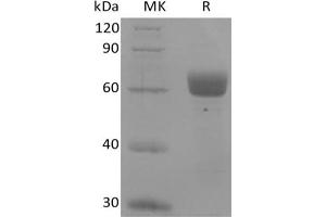 Western Blotting (WB) image for Butyrophilin-Like (LOC100045026) protein (Fc Tag) (ABIN7319908) (Butyrophilin Protein (Fc Tag))