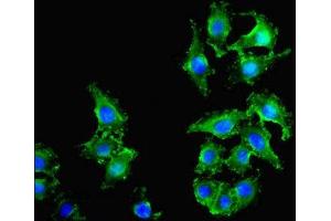 Immunofluorescence staining of A549 cells with ABIN7162378 at 1:400, counter-stained with DAPI. (OLR1 anticorps  (AA 58-273))