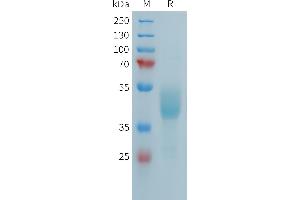 Human F(752-834) Protein, hFc Tag on SDS-PAGE under reducing condition.