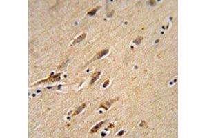ARF1 antibody immunohistochemistry analysis in formalin fixed and paraffin embedded human brain tissue.