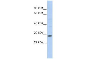 WB Suggested Anti-RAB38 Antibody Titration:  0. (RAB38 anticorps  (N-Term))