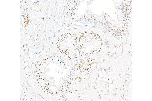 Immunohistochemistry (IHC) image for anti-Thyroid Hormone Receptor Associated Protein 3 (THRAP3) (C-Term) antibody (ABIN7454699) (THRAP3 anticorps  (C-Term))