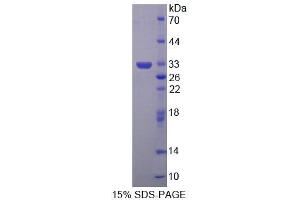 SDS-PAGE (SDS) image for 4-Aminobutyrate Aminotransferase (ABAT) (AA 249-500) protein (His tag) (ABIN4990071) (ABAT Protein (AA 249-500) (His tag))