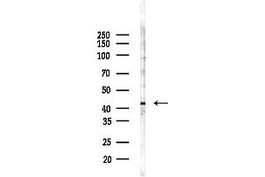 Western blot analysis of lysates from COLO205 cells(heat-shock,45 min treatment), using CADM3 Antibody at 1/1000 dilution.
