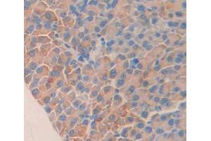 Used in DAB staining on fromalin fixed paraffin- embedded Kidney tissue (STAT1 anticorps  (AA 432-680))