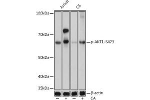 Western blot analysis of extracts of various cell lines, using Phospho--S473 mAb (ABIN6135179, ABIN6135970, ABIN6135971 and ABIN7101880) at 1:1000 dilution. (AKT1 anticorps  (pSer473))