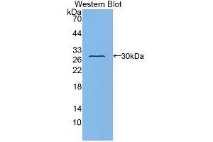 WB of Protein Standard: different control antibodies against Highly purified E.