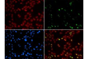 Immunofluorescence analysis of GFP-RNF168 trangenic U2OS cell using SUMO1 antibody. (SUMO1 anticorps  (AA 1-101))