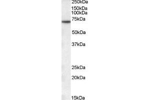 ABIN184636 (0. (MTM1 anticorps  (C-Term))