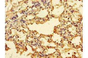 Immunohistochemistry of paraffin-embedded human lung tissue using ABIN7156249 at dilution of 1:100 (ING3 anticorps  (AA 51-223))