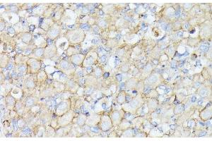Immunohistochemistry of paraffin-embedded Rat ovary using MADCAM1 Polyclonal Antibody at dilution of 1:100 (40x lens). (MADCAM1 anticorps)