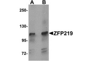 Western blot analysis of ZFP219 in mouse brain tissue lysate with ZFP219 antibody at (A) 1 and (B) 2 μg/ml. (ZNF219 anticorps  (N-Term))