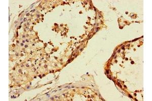 Immunohistochemistry of paraffin-embedded human testis tissue using ABIN7172291 at dilution of 1:100